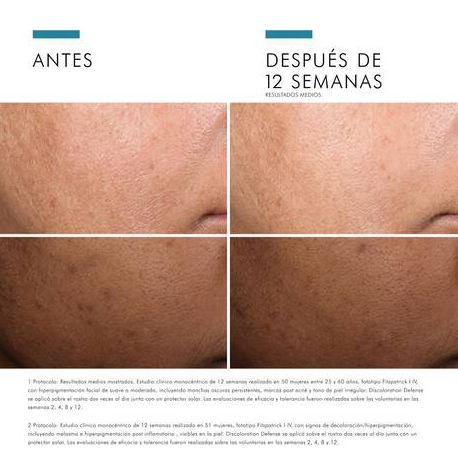 SKINCEUTICALS DISCOLORATION DEFENSE 30 ML