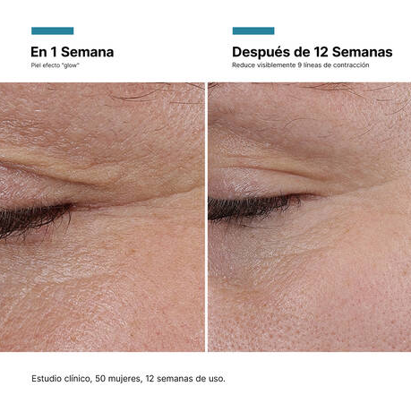 SKINCEUTICALS P-TIOX 30 ML